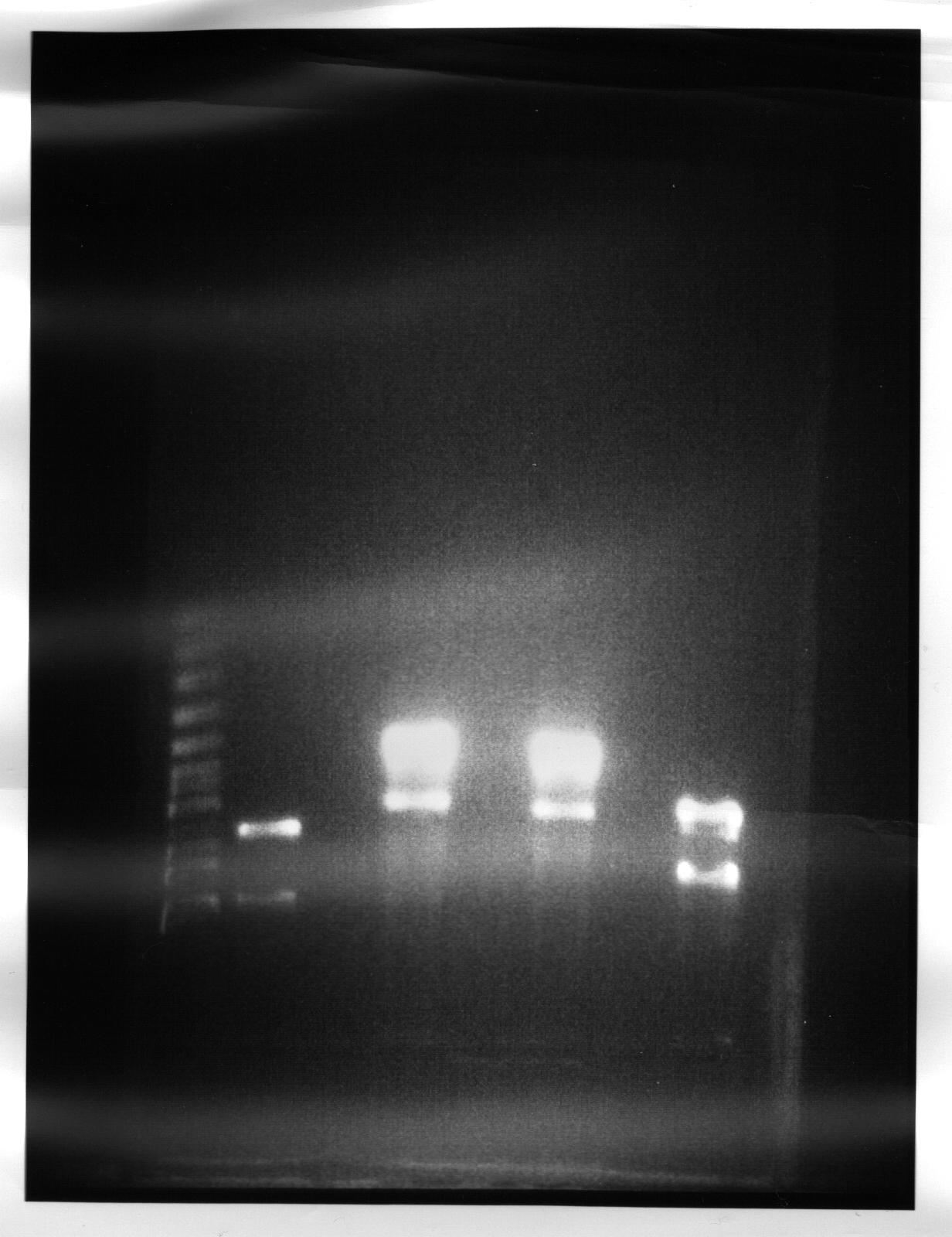 Gel Electrophoresis